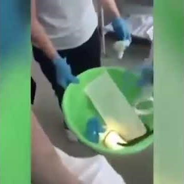 Watch the horrific moment doctors pulled out 4 feet Snake from a woman's throat.