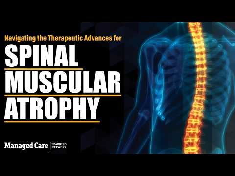 Spinal Muscular Atrophy: Navigating Recent Therapeutic Advances