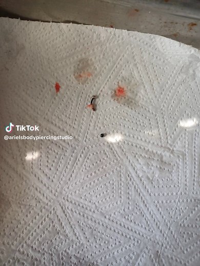 This was put on a client's nipple piercing and because of the weather,her nipple swelled and the ball went inside her nipple. I had to basically use a needle to pierce it again and push out the jewellery. Please do your research when it comes to body piercings. This would have ended up much worse.