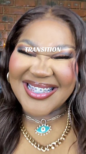Transforming Smiles: Kamo's Braces Journey