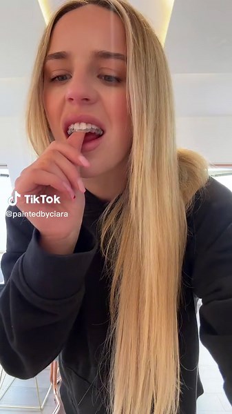 Invisalign Transformation: Stunning Style Tutorial