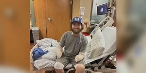 Lineman who lost most of his arms after being severely shocked counts his blessings
