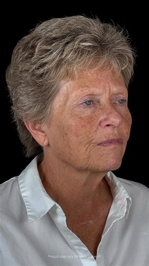 퐓퐇퐄 퐀퐑퐓 퐎퐅 퐋퐎퐎퐊퐈퐍퐆 퐋퐈퐊퐄 퐘퐎퐔퐑퐒퐄퐋퐅 퐀퐆퐀퐈퐍! ⁠ 헣헿헼헰헲헱혂헿헲(혀): Deep...