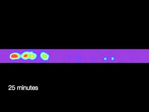 Proteins Assembling on Single-strand DNA