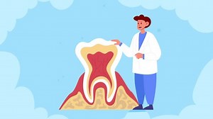 Dentist Talks About Protecting Your Teeth Stock Footage Video (100% Royalty-free) 3603529373 | Shutterstock