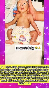 44K views · 1.1K reactions | 34 weeks baby premature,Please pray for baby 鹿爐爐爐 #prematurebaby #preemiebaby #Newbornbaby #NICU #FYP #USA | Nita Veronica | Facebook