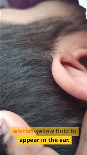 Ear Discharge Causes, Symptoms, and Treatment Options