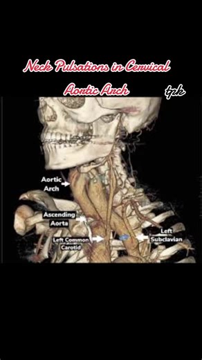 Pulsating Neck Mass: Understanding Cervical Aortic Arch
