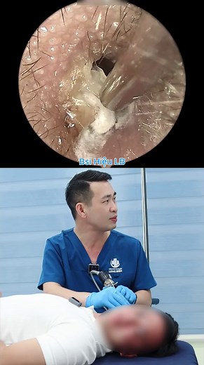 Nấm Trắng và Dị Hình Ống Tai
