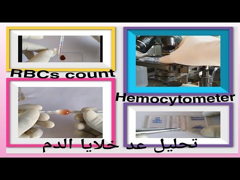 كيف يتم عمل تحليل عد خلايا الدم الحمراء RBCs count/ hemocytometer/Procedure and Calculations