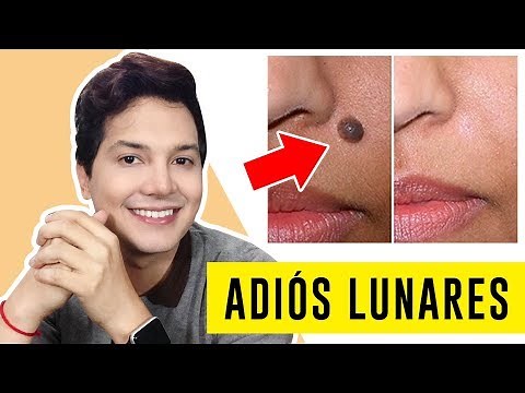 HOW TO GET RID OF MOLES WITH HOMEMADE REMEDIES