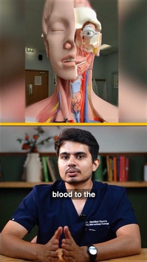 Carotid Artery Blockage Explained | A Silent Cause of Stroke You Should Know