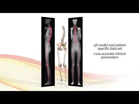 University Orthopedics Offers EOS Imaging