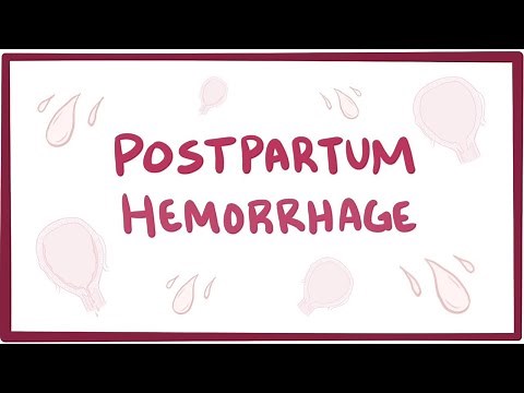 Postpartum hemorrhage - causes, symptoms, diagnosis, treatment, pathology