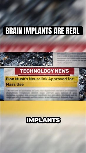 Soon Everyone Will Have Access To Neural Implants #futuretech #neuralink #shorts