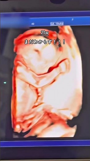 妊娠6か月、20週〜23週のリアル🤰🏻つわり終了から初めての胎動まで