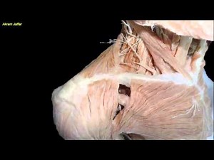 Fracture of the clavicle - applied anatomy • Video • MEDtube.net