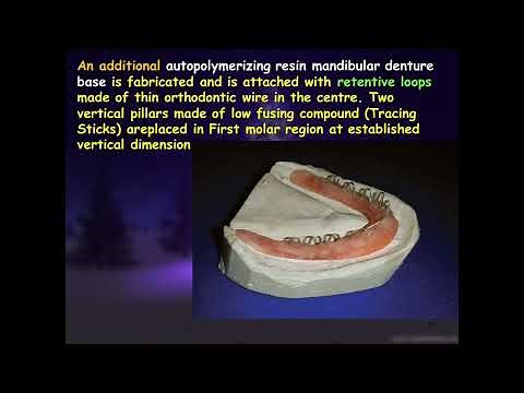 Prosthodontics L7 (Neutral Zone Concept)