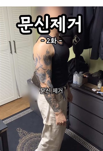 문신 제거 1회차 비용, 후기