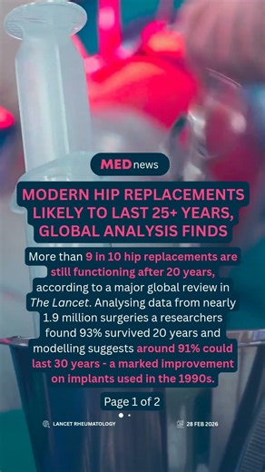 🦴 More than 9 in 10 hip replacements still working after 20 years #healthnews #orthopedics
