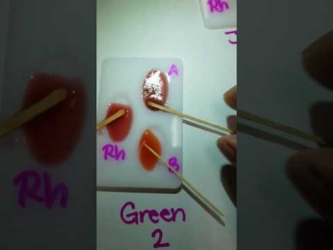 ABO Blood Typing Lab Demonstration