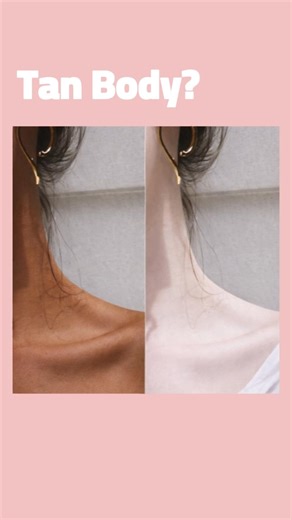 Remove Body Tan Naturally | Easy DIY Tan Removal Tips #glowup #skincaretips #trending #viral #diy