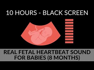 REAL FETAL HEARTBEAT FOR BABIES | BABY DOPPLER SOUND | 8 MONTHS