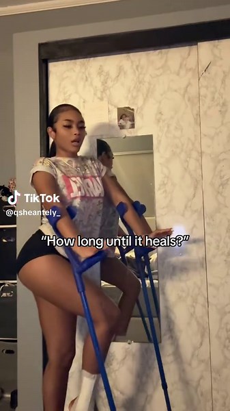 Understanding Surgery Recovery Timelines