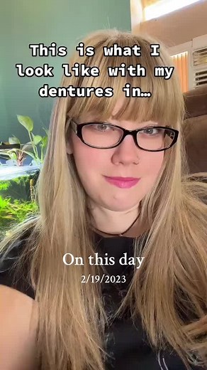Dentures in vs. dentures out. #denturegang #dentureconfidence #denturesatayoungage #denturetok #denturecommunity #dentureremoval #dentureprocess #denturesmile #denturegirl #denturesandbeauty