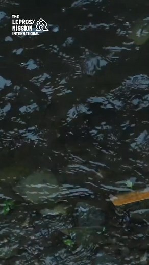 Life after leprosy is full of possibilities. In commemoration of the International Day of Persons with Disabilities, we want to acknowledge and honour these skilled artisans who are building purposeful lives beyond leprosy in Nepal. Thank you to The Leprosy Mission Nepal Leprosy Mission Nepal for taking us to this incredible experience. | The Leprosy Mission International