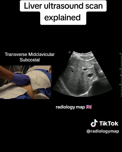 Liver Ultrasound Scan Explained: Techniques and Insights