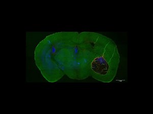 Identifying how a fungus causes damage to the brain