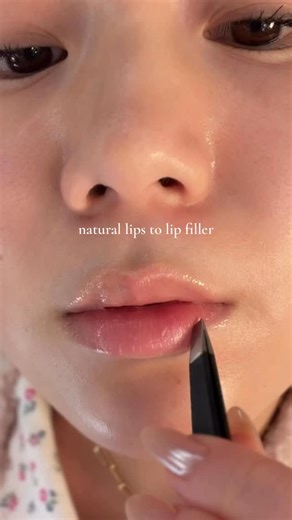 Song Of Skin | volufiline is the key 🔑 Using SKIN1004 MATRIXYL 10% #Skincare101 #skincare #lipfiller #skin1004 | Instagram
