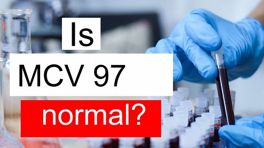 Is MCV 97 normal, high or low? What does Mean corpuscular volume level 97 mean?