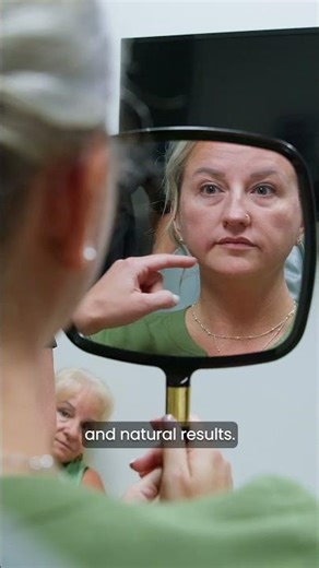 Filler After Weight Loss | Restore Facial Volume ✨