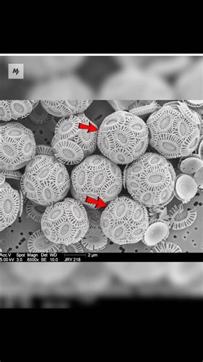 Look at how it appears under the microscope.
