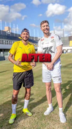 Mr. Beast Before Vs After Life Transition #hit #viral#mrbeast #mrbeastshorts #usa #usashorts #edit