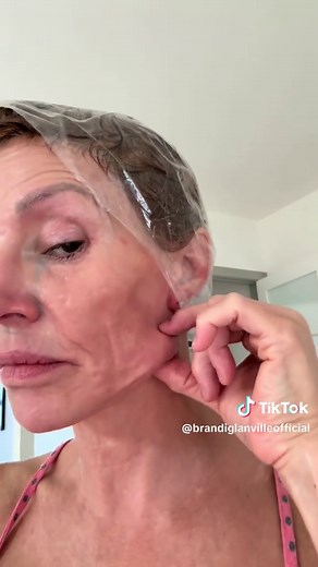 I’m finally sharing some of my worst moments leading up to getting diagnosed. I’m fighting highly resistant ESBL Klebsiella & Enterobacter with biofilm, Valley Fever, Demodex dermatitis & mono. I also have a fungal ball in my face that needs to be removed. I have surgeries ahead, months of daily IV treatment and so far very little improvement. Even with insurance, this is costing me $3,300–$6K a month and I’m barely able to work. I honestly don’t know how I’m going to do this mentally or financi