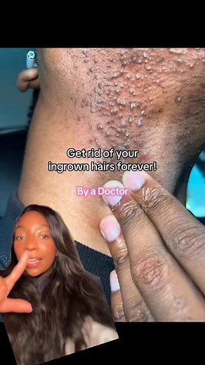Dr Nicole J on Instagram: "You never need to suffer with ingrown hairs ever again! Ingrown hairs are actually the worst and can be quite painful! Here’s my guide to never deal with them ever again! Most important though is to stop shaving especially if you have a coarser, curlier hair type. The hair naturally curls back into the skin and shaving the hair short is what really promotes this happening! #ingrownhairs #bodycare #hygienetips #glowingskin #everythingshower #selfcare"