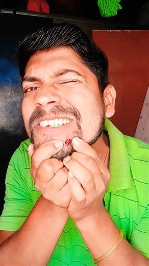 That Beard Problem Got Worse 😭😂