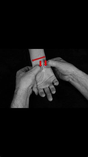 🖐️ Kleinman Shear Test Explained #wristpain #meded #physiotherapy #ATC #ortho #medicaleducation