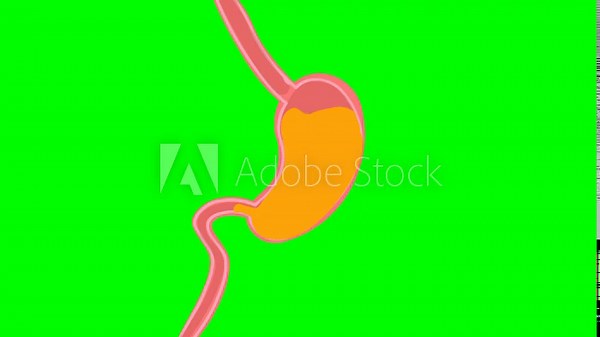 Stomach acid reflux animation on green screen. Open valve illustration. Gastric acid rising. GERD condition. Heartburn symptoms. Medical digestive issue.
