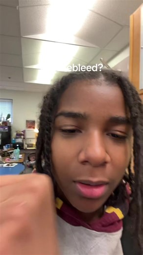 i gave myself such a nosebleed #nosebleed