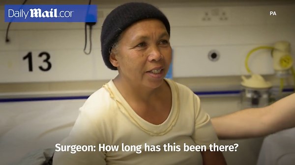 Lady with a massive lump on her back is dubbed a 'monster'