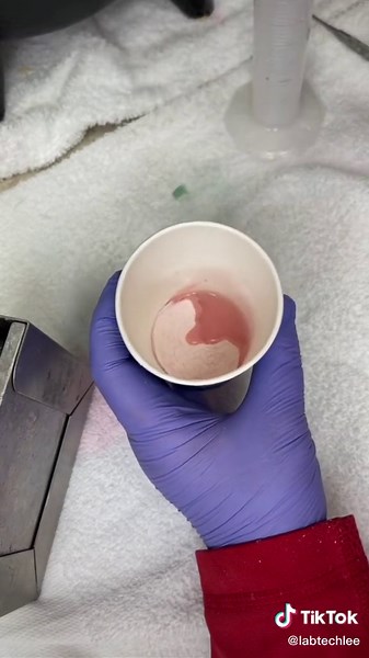 Processing a Lower Denture for Life-changing Results