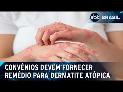Health plans will have to provide medication for atopic dermatitis | SBT Brasil (06/04/24)