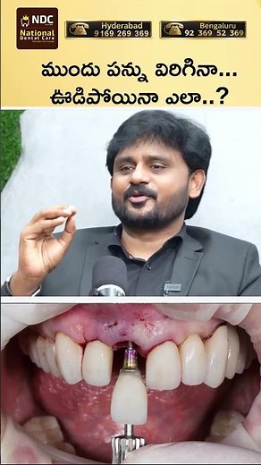 Missing Front Tooth? Here’s What You Can Do! | Best Tooth Replacement Options at NDC