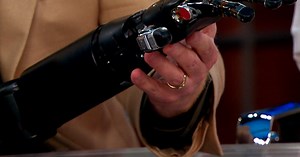 Watch: Bionic arm can be controlled by brain