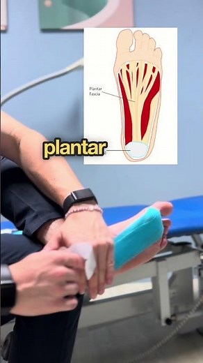 Fix Your Arch Pain with This One Tape Technique #plantarfascia #podiatry