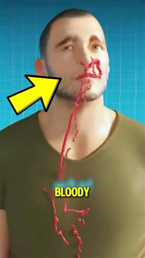 Why Does Your Nose Bleed Out of Nowhere?